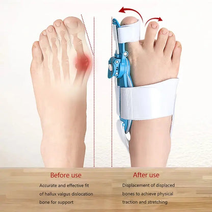Adjustable Hallux Valgus Corrector Brace for Bunion & Toe Alignment Support